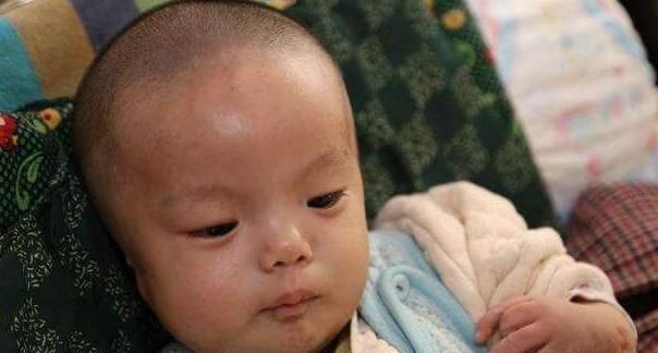 宝宝|这个“夏天神器”让宝宝成“脑瘫”,大多家庭仍在用,家长快住手