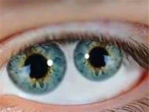 有何|古代拥有“双重瞳孔”的人有哪些他们眼中的世界与常人有何不同
