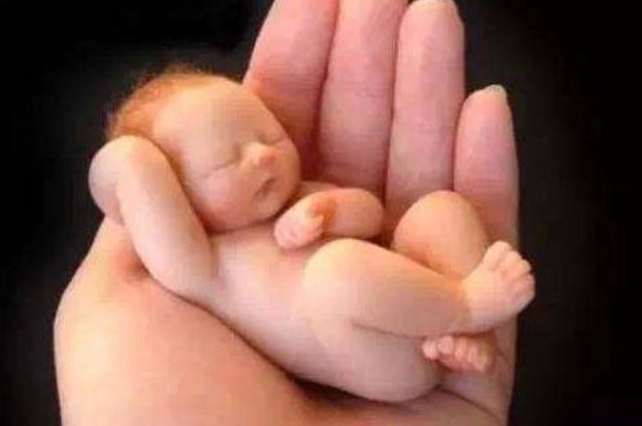 小头症|世界上最小的婴儿,曾经把蛋壳当成摇篮,如今却变成了这副模样!