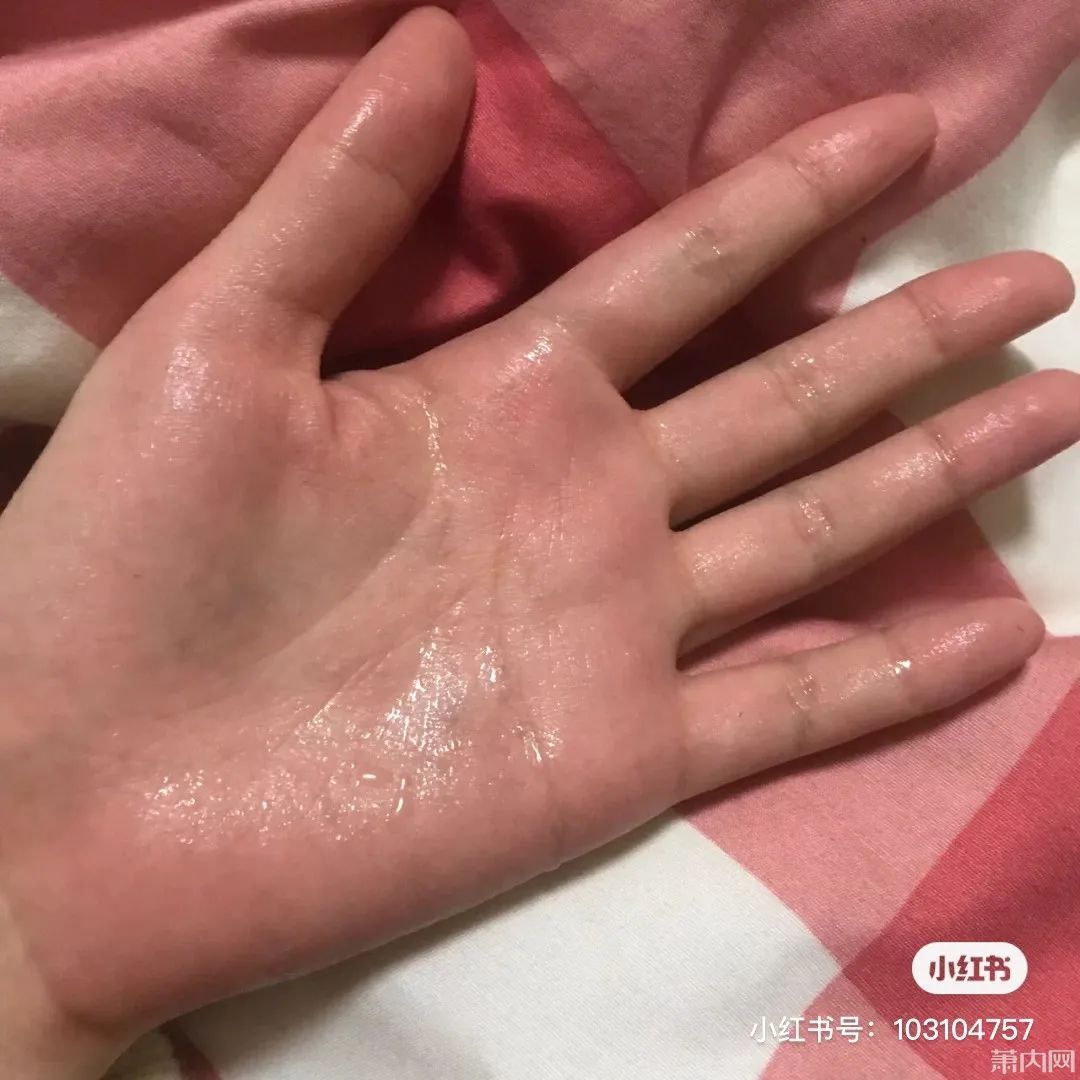 手术|姑娘这个尴尬多年的病症，终于下决心做了手术！经历值得一看