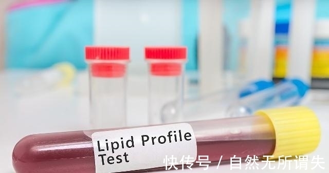 血液|血管的“清洁剂”找到了,饭前吃一点,血液不粘稠,高血脂降低了