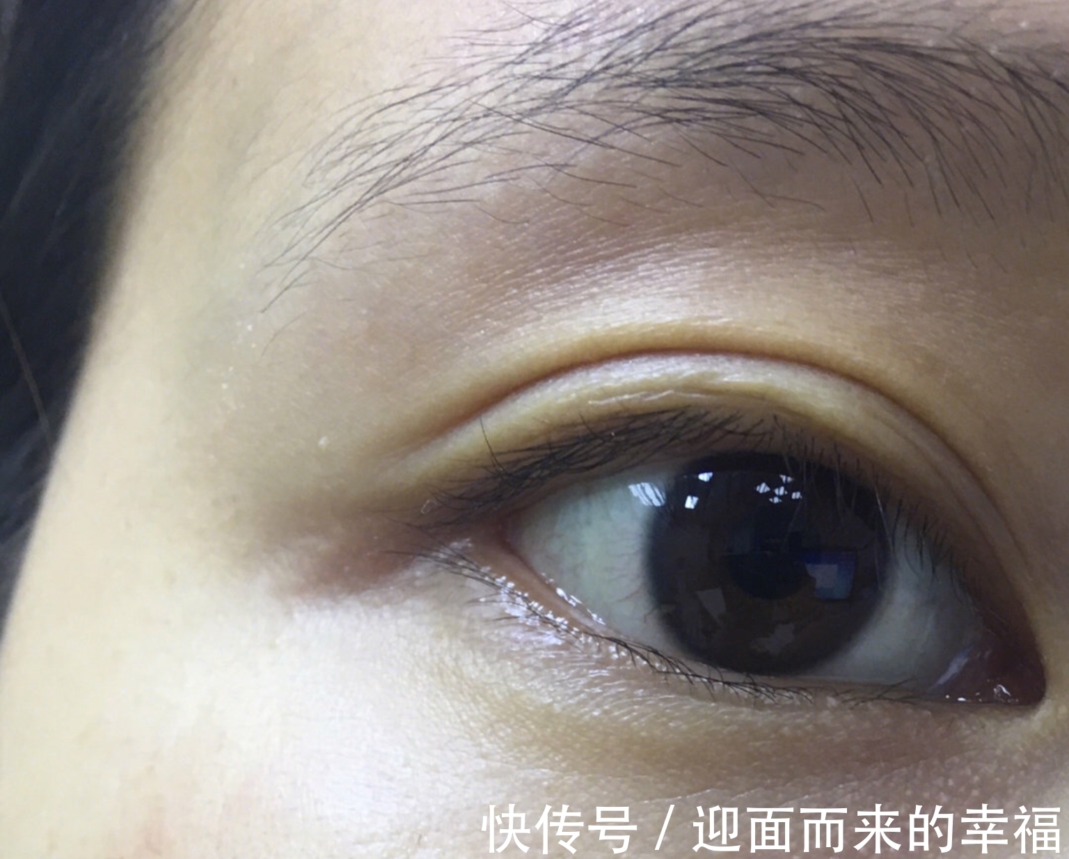 皮肤 护肤“谣言”的13个坑,你是不是全中?