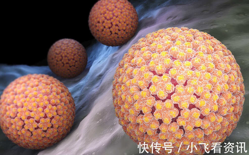 身体|身体3个地方发痒,是HPV来了,趁早去检查,别误以为是过敏