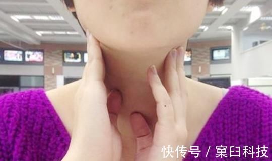 黄瓜|甲状腺有结节的人,常吃四物,活血散结,结节或能慢慢消下去