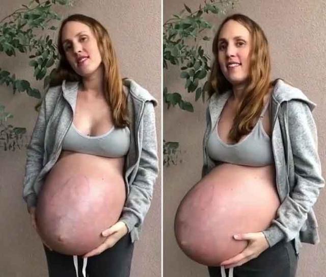 肚子|怀上三胞胎肚子会有多大,孕妈妈分享大肚照震撼人心