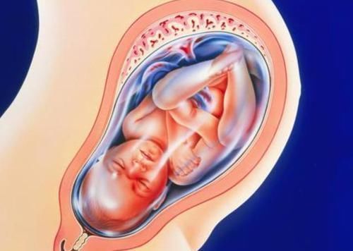 逆袭|90后宝妈生下“小包公”,全家人都嫌丑,两个月后逆袭成“团宠”