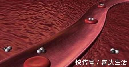 可溶性纤维|它是餐桌上的“降血脂药”,每天坚持吃一点,轻轻松松降血脂