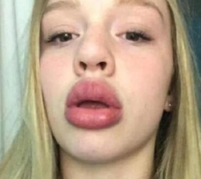 公认最丑的3大“唇形”,第2种是女生的最爱,直男照照镜子吧