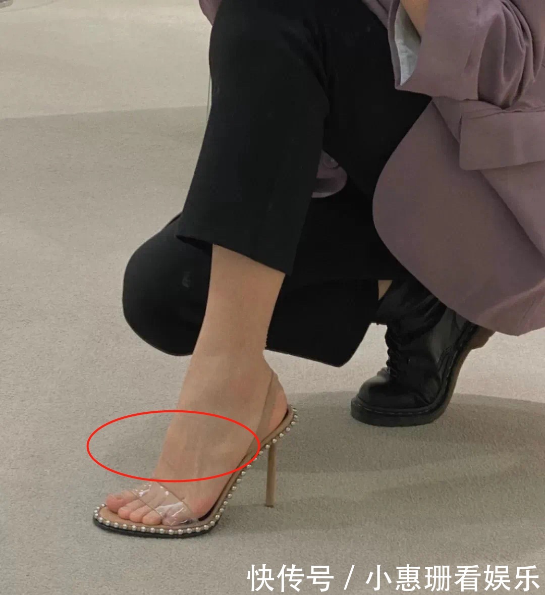 脚背|凉鞋该换了!我劝你穿这4双,太好看了