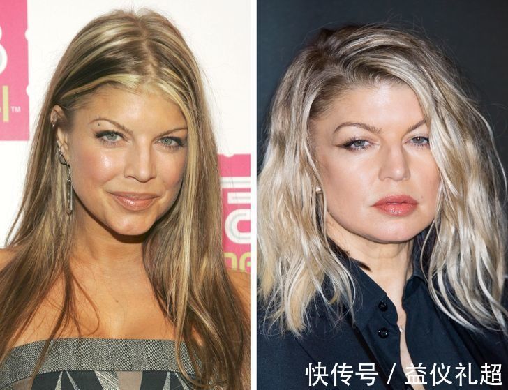 真实年龄|9个“直接戳破真实年龄”的衰老迹象,化妆也遮不住