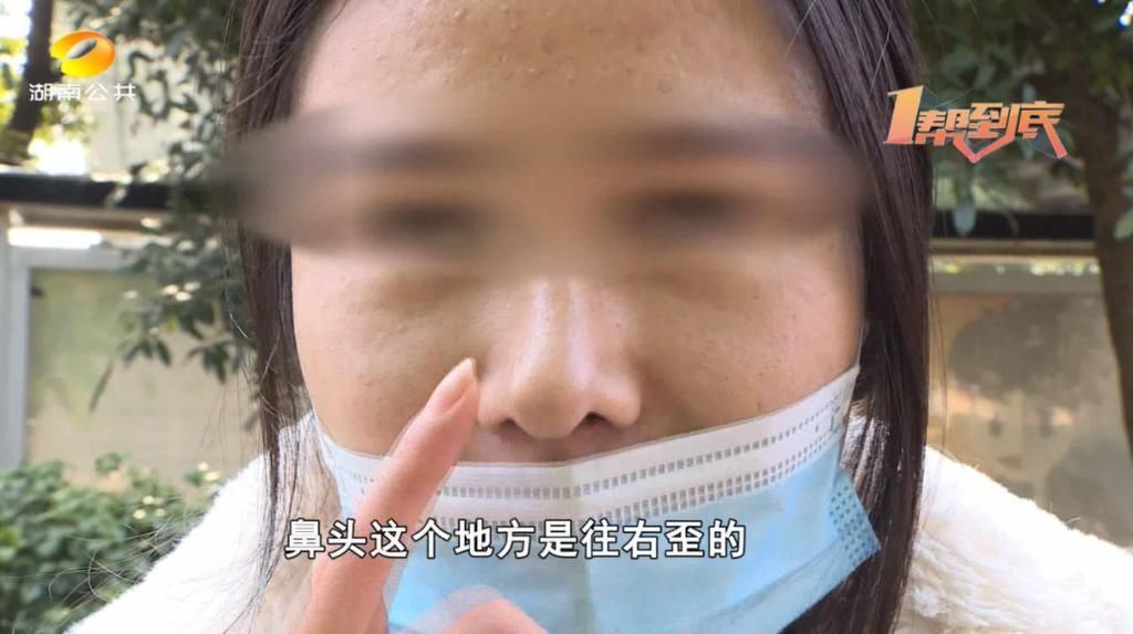 刘女士|我的鼻子整歪了,乔雅医美:拍视频让你“火”!