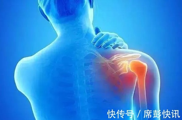 陈醋|秘方来了!一碗老陈醋,赶走头晕手麻,和颈椎病、肩周炎说拜拜