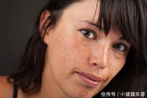 内分泌失调|女性内分泌失调，身体的6个变化一目了然，若你有，及时调节