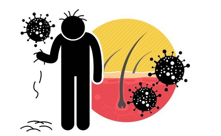 毛发 一个植发至少上万元?想要保住头发和钱包,别忘了做好4件事