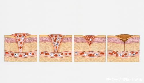 脂质|血脂的“帮凶”找到了，主任医生每天补一物，坚持半月，血管净