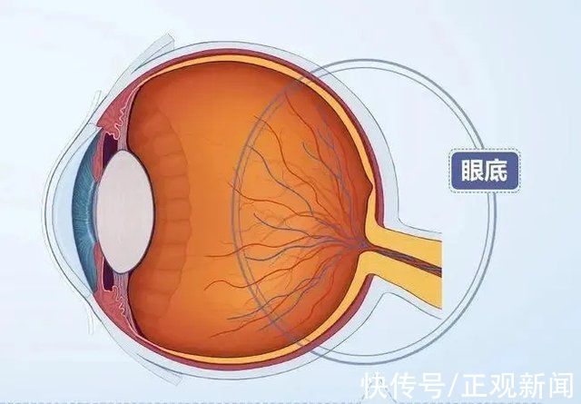 视网膜|眼病精准诊断再升级!郑州尖峰眼科引进蔡司CLARUS 500真彩超广角眼底相机