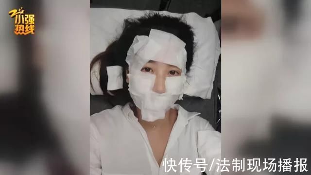 高女士|杭州23岁女子做医美，脸上发生奇怪变化:上下嘴唇对不齐了