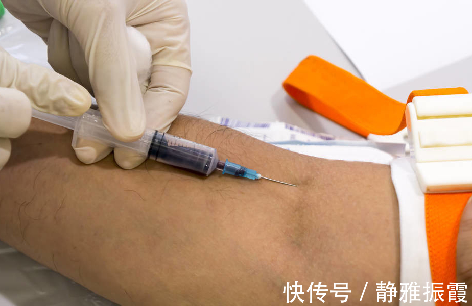 心血管堵塞|低密度脂蛋白升高意味着什么,容易心肌梗死和脑梗塞,怎样降低它