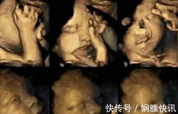 小聆|7个月孕妈去产检,发现胎儿“捂鼻子”,了解情况后医生怒斥孕妈