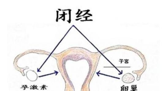  女人|上环的女人，到了此年龄，节育器就要取下来，不然子宫会受伤害