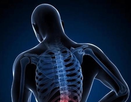 腰肌劳损|花椒+红糖太厉害了，腰腿不痛不麻了，坐骨痛也拜拜了！