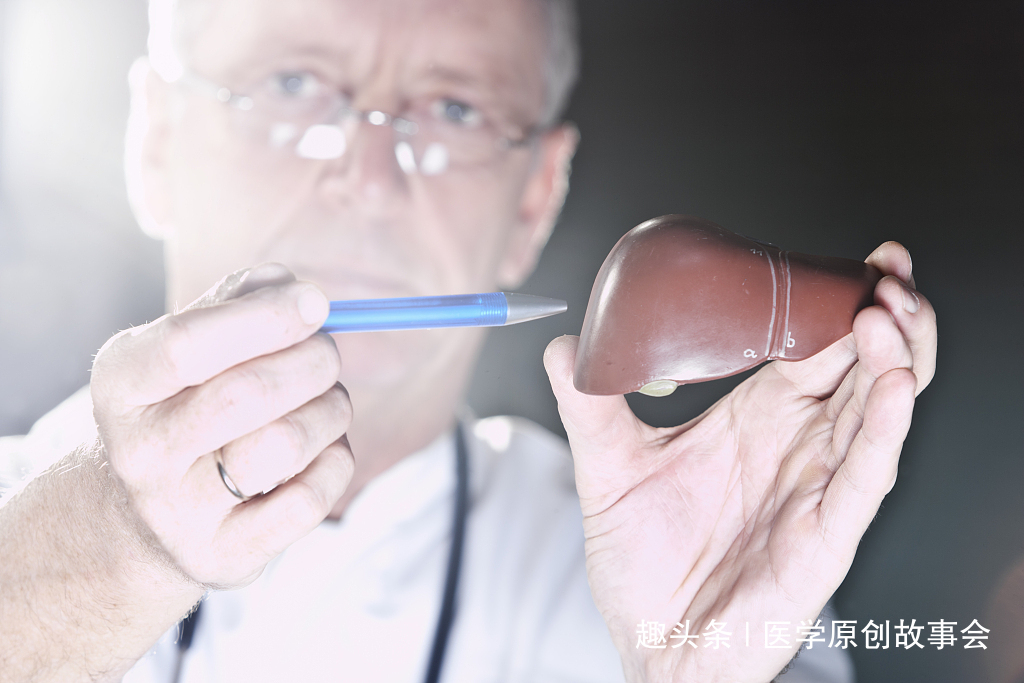 静脉曲张|体内有肝硬化，身体往往有五个标志，占的越多，越要及时治疗