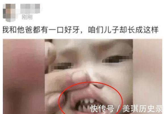 宝妈|3岁男孩长出“鲨鱼牙”,妈妈着急送医检查,医生:无知的父母