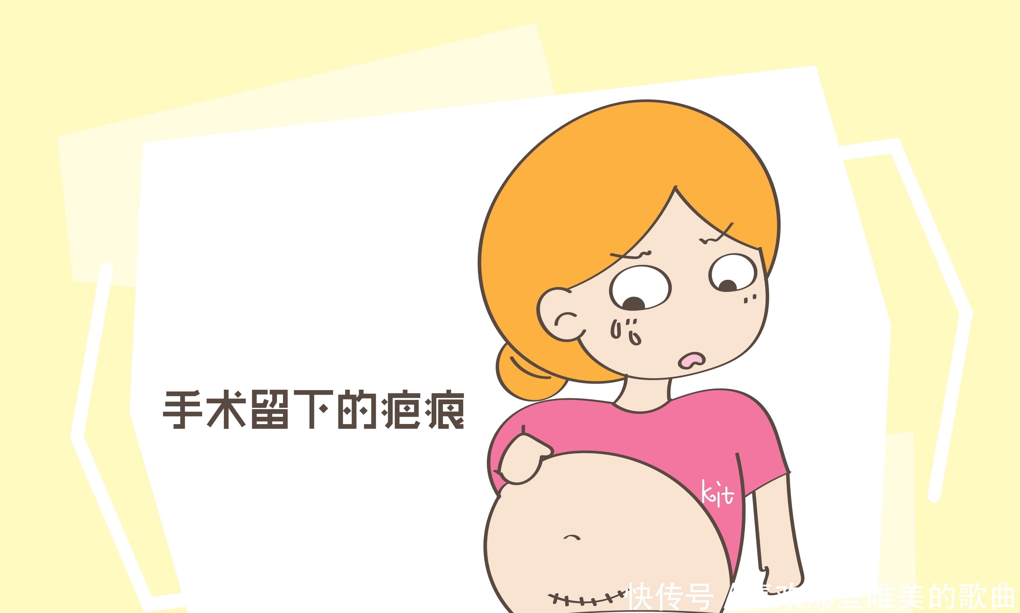 选择|不能顺产只能选择剖腹产,是竖切还是横切要多多考虑