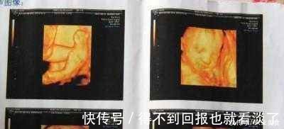 四维彩超|孕期,做“四维彩超”时能看出宝宝性别或许聪明孕妈都能看明白