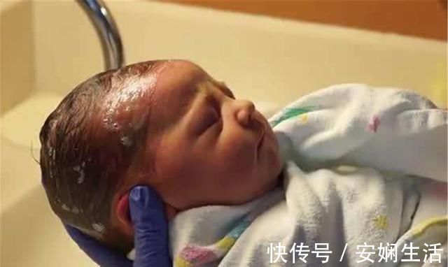 头垢|宝宝身上有异味?可能是疾病发出的“信号”,日常护理要注意