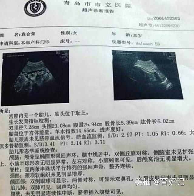 最强孕妈|“最强孕妈”怀孕6个月，全身肌肉仍旧明显，网友这是孕妈