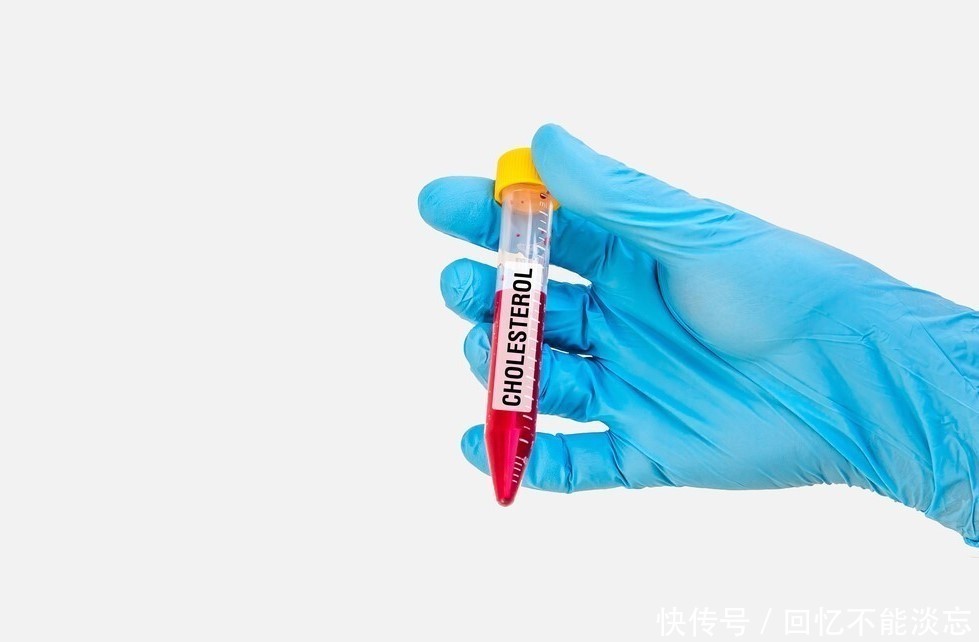 动物性油脂|62岁的奶奶,甘油三酯从126到15,坚持吃一物是妙招