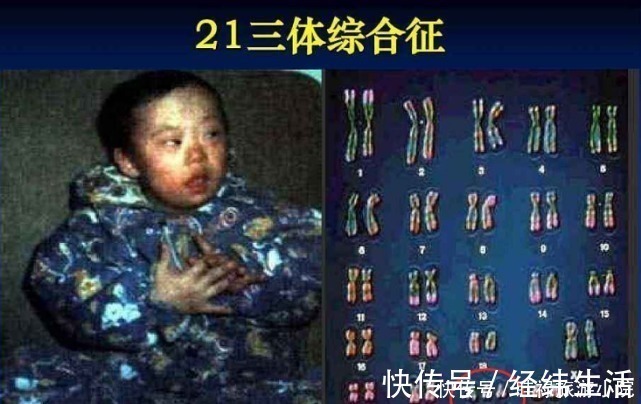 透明膜|孕期产检不想生个“傻孩子”，这三项产检必须按时做，不能忽视