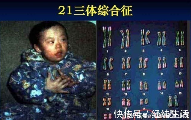 透明膜|孕期产检不想生个“傻孩子”,这三项产检必须按时做,不能忽视