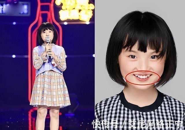 刷牙|17岁儿子长尖牙,亲妈吐槽像“吸血鬼”,网友:也可能是个狼人