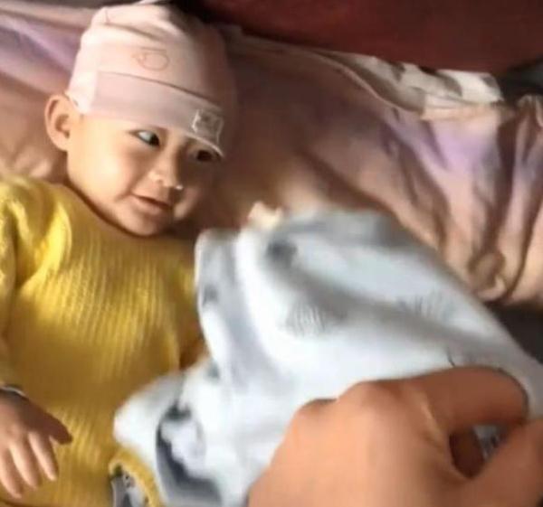 妈妈|宝宝表面没什么,妈妈一掀开被子,网友:永远不知道他在经历什么