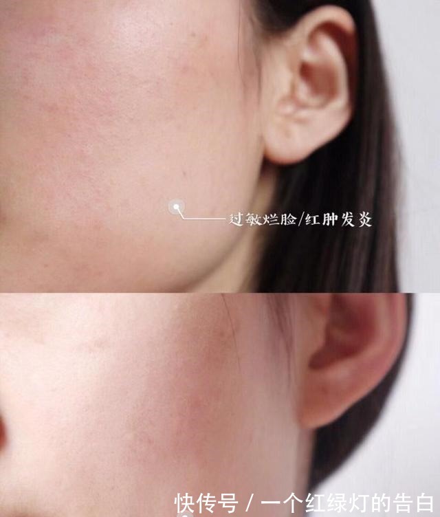 涂抹 皮肤出现各种问题,掌握正确的护肤步骤,让你的皮肤细腻有光泽!