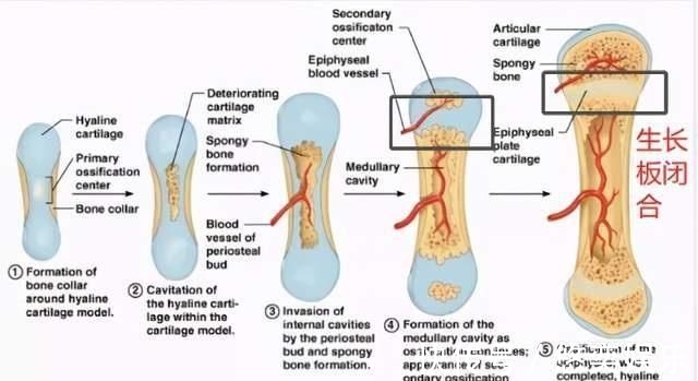西弗特|孩子能不能长高,与骨龄有很大关系,要给孩子定期测量