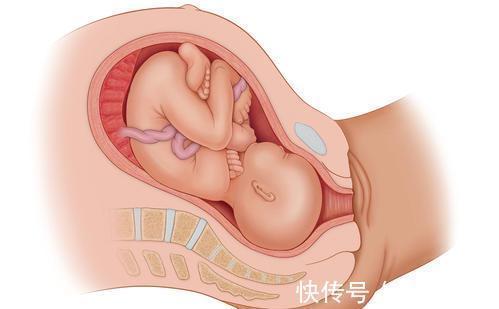 部位|孕晚期胎动在这个部位,说明胎儿入盆了
