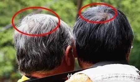 毛发|老中医推荐：最有效的白发转黑方，仅2味药材泡水喝，补虚又乌发