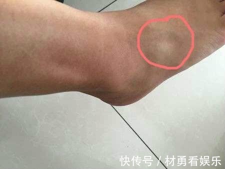 肢端|身上有三道“邪印儿”,说明健康要出问题