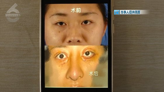  整出|女子花3万6整出了“阿凡达、通天鼻、闭不上的眼”