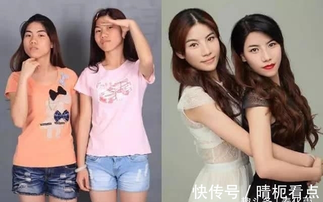 美白|实拍:10张女孩整容前后的对比照,这真就是换了一张脸