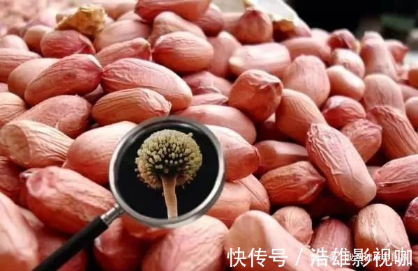 家里4个地方，是“黄曲霉毒素”最喜欢的，一会记得去清理