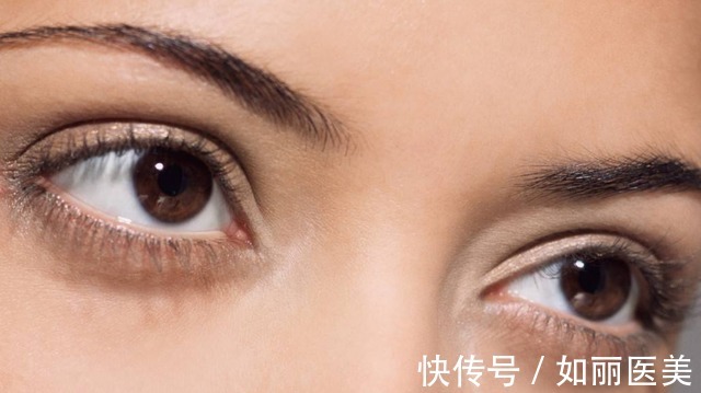 重睑 什么是割双眼皮呢?割双眼皮手术都包含哪些项目?你都了解吗