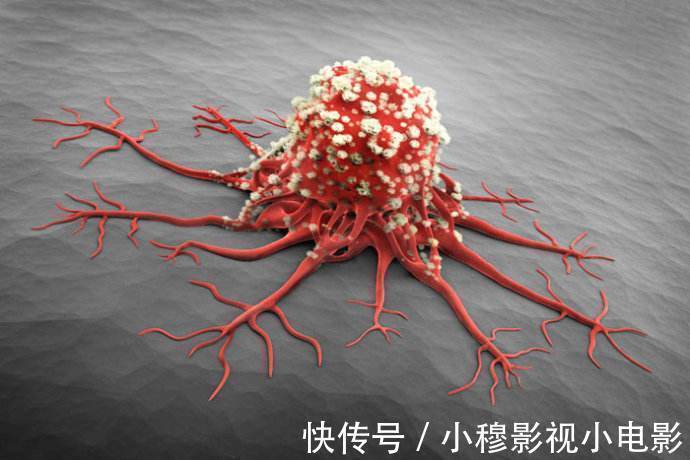 喝酒|为什么肝癌患者在中国居多?“罪魁祸首”不是喝酒和熬夜,而是它