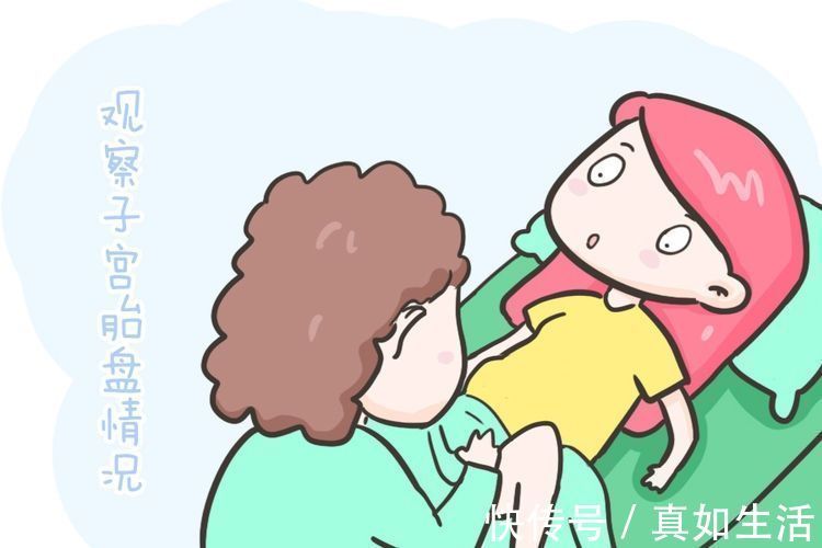 strong|为什么顺产的孕妈不能立即回病房,剖宫产却可以,无非这三点原因