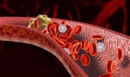 血管堵不堵,看脚就知,若你脚上没有3个现象,恭喜,血管还年轻