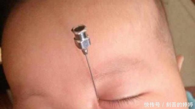 6个月女童泪流不止,医生将针扎入眼角,流出的液体让妈妈吓坏了