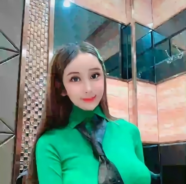 光额头 8年的整形手术花费了100多万,光额头就打了200多支玻尿酸